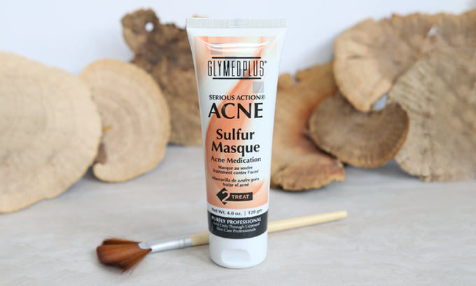 Excess Oil - Fuel to the Acne Flame