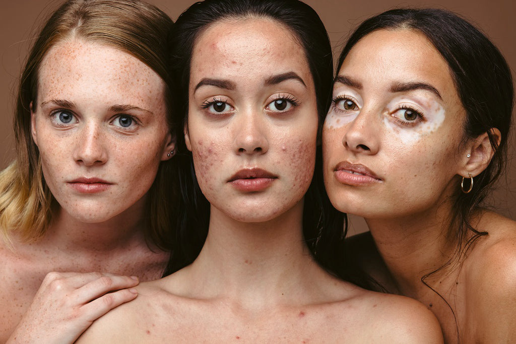 Normalize Real Skin