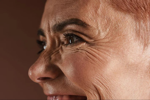 HOW TO COMBAT EYE WRINKLES: STRATEGIES FOR EFFECTIVE WRINKLE REDUCTION